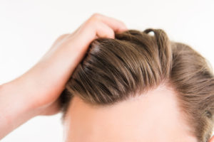 Close up photo of a man pulling is hair back after a hair transplant